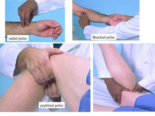 20
radial pulse Brachial pulse
popliteal pulse
 
