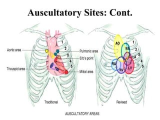 25
Auscultatory Sites: Cont.
 
