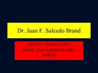 Dr. Juan F. Salcedo Brand MEDICO RADIOLOGO HOSP. UNIVERSIDAD DEL NORTE 