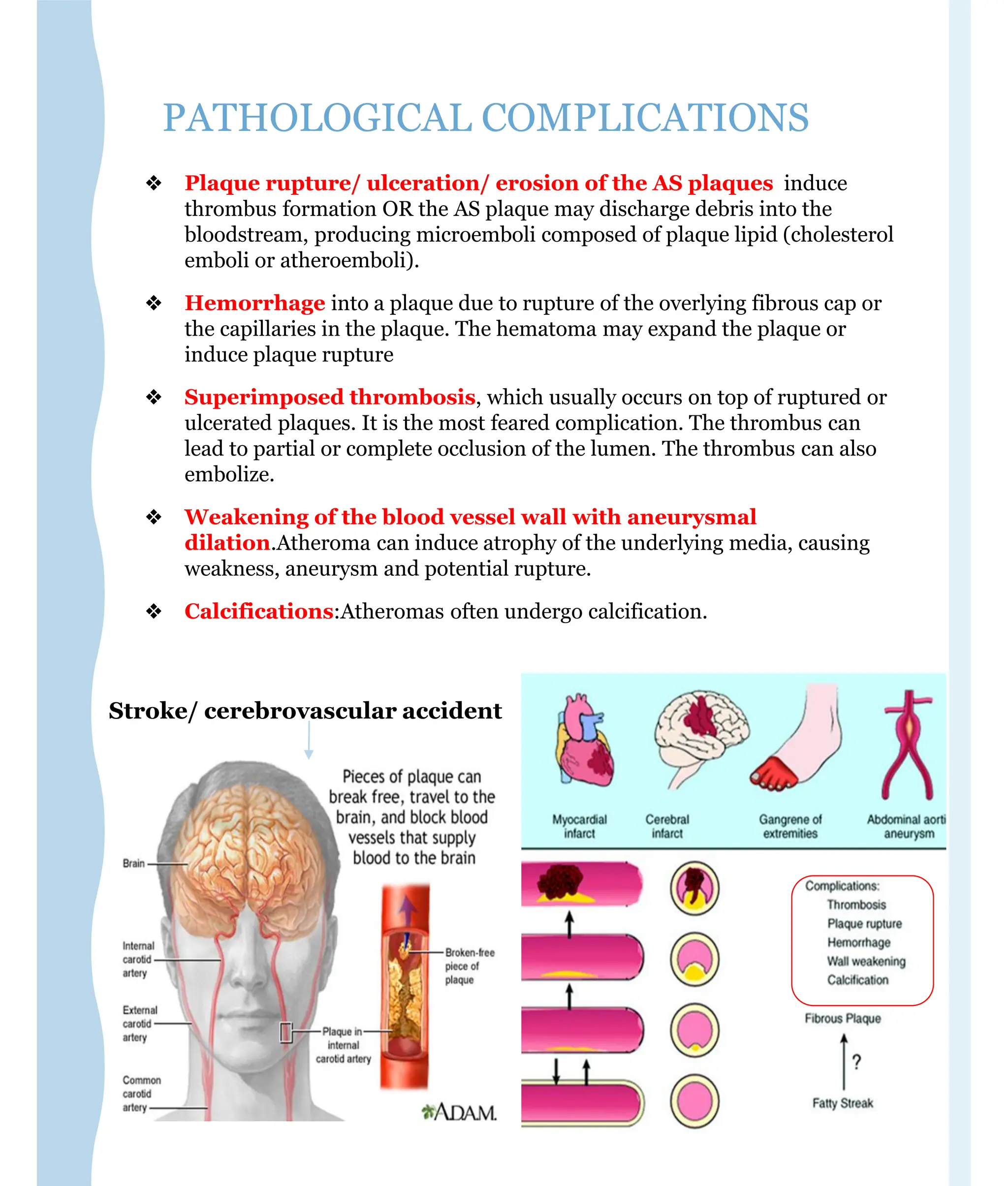2- ATHEROSCLEROSIS and its pathophysiology | PDF