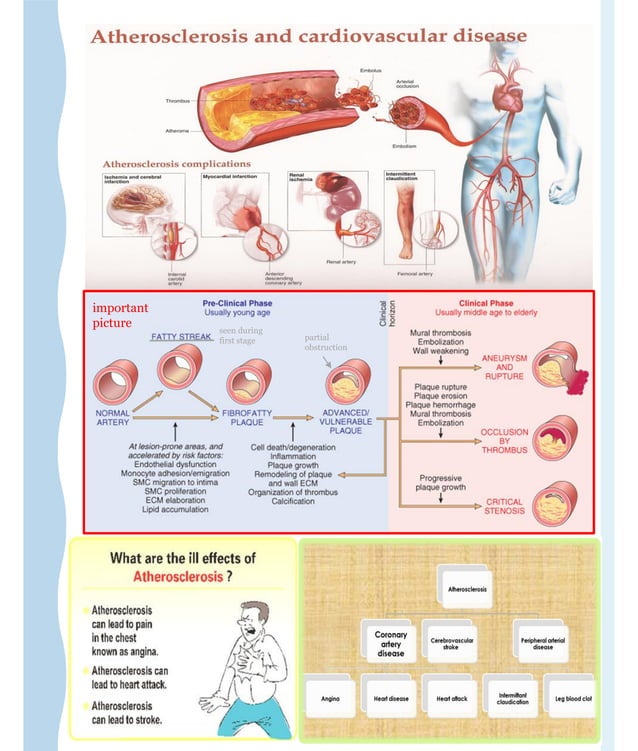 2- ATHEROSCLEROSIS and its pathophysiology | PDF