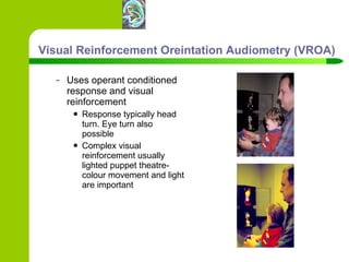 Visual Reinforcement Oreintation Audiometry (VROA) Uses operant conditioned response and visual reinforcement Response typically head turn. Eye turn also possible Complex visual reinforcement usually lighted puppet theatre- colour movement and light are important 