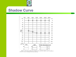 Shadow Curve 