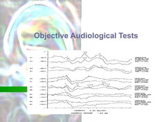 Objective Audiological Tests 
