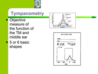 Tympanometry Objective measure of the function of the TM and middle ear 5 or 6 basic shapes 