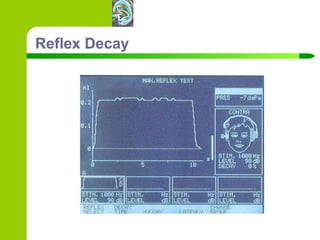 Reflex Decay 