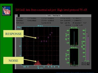 RESPONSE NOISE 