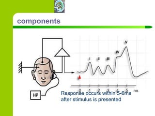 components Response occurs within 5-6ms after stimulus is presented 