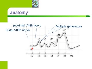 anatomy Distal VIIIth nerve proximal VIIIth nerve Multiple generators 