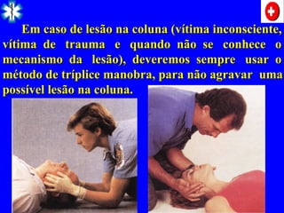 Em caso de lesão na coluna (vítima inconsciente,
Em caso de lesão na coluna (vítima inconsciente,
vítima de trauma e quando não se conhece o
vítima de trauma e quando não se conhece o
mecanismo da lesão), deveremos sempre usar o
mecanismo da lesão), deveremos sempre usar o
método de tríplice manobra, para não agravar uma
método de tríplice manobra, para não agravar uma
possível lesão na coluna.
possível lesão na coluna.
 