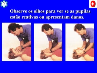Observe os olhos para ver se as pupilas
Observe os olhos para ver se as pupilas
estão reativas ou apresentam danos.
estão reativas ou apresentam danos.
 