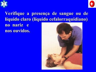 Verifique a presença de sangue ou de
Verifique a presença de sangue ou de
líquido claro (líquido cefalorraquidiano)
líquido claro (líquido cefalorraquidiano)
no nariz e
no nariz e
nos ouvidos.
nos ouvidos.
 