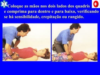 Coloque as mãos nos dois lados dos quadris
Coloque as mãos nos dois lados dos quadris
e comprima para dentro e para baixo, verificando
e comprima para dentro e para baixo, verificando
se há sensibilidade, crepitação ou rangido.
se há sensibilidade, crepitação ou rangido.
 