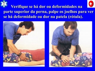 Verifique se há dor ou deformidades na
Verifique se há dor ou deformidades na
parte superior da perna, palpe os joelhos para ver
parte superior da perna, palpe os joelhos para ver
se há deformidade ou dor na patela (rótula).
se há deformidade ou dor na patela (rótula).
 
