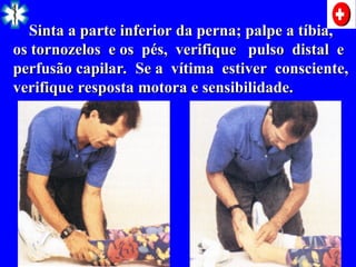 Sinta a parte inferior da perna; palpe a tíbia,
Sinta a parte inferior da perna; palpe a tíbia,
os tornozelos e os pés, verifique pulso distal e
os tornozelos e os pés, verifique pulso distal e
perfusão capilar. Se a vítima estiver consciente,
perfusão capilar. Se a vítima estiver consciente,
verifique resposta motora e sensibilidade.
verifique resposta motora e sensibilidade.
 