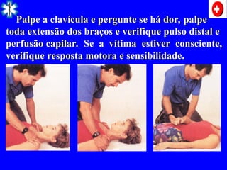 Palpe a clavícula e pergunte se há dor, palpe
Palpe a clavícula e pergunte se há dor, palpe
toda extensão dos braços e verifique pulso distal e
toda extensão dos braços e verifique pulso distal e
perfusão capilar. Se a vítima estiver consciente,
perfusão capilar. Se a vítima estiver consciente,
verifique resposta motora e sensibilidade.
verifique resposta motora e sensibilidade.
 