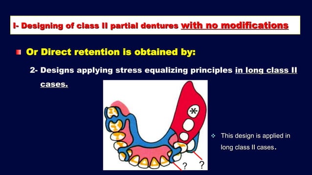 2- b. Basic principles for designing Kennedy class II, III and IV ...