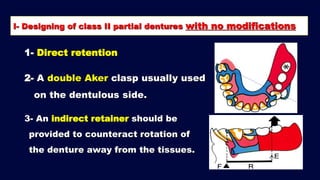 2- b. Basic principles for designing Kennedy class II, III and IV RPD ...