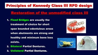 2- b. Basic principles for designing Kennedy class II, III and IV RPD ...