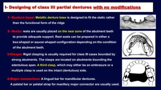 2- b. Basic principles for designing Kennedy class II, III and IV RPD ...