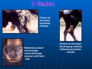 Chains of
              ulcerated
              lymphatic
              nodules




                          Chains of ulcerated,
                          discharging nodules
Bilateral purulent
                          following lymphatic
hemorrhagic
                                versals
nasal discharge
)scanty( with fetid
 odor
 