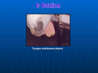 Tongue withdrawal absent
 