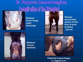 Sharply
Bilateral
                             demarcated
hemorrhagic
                             edema of fore
nasal
                             limb at level
discharge
                             of elbow
                              .))arrow




Bilateral
venous
epistaxis




              Petechial hemorrhages
                  in vaginal m.m
 