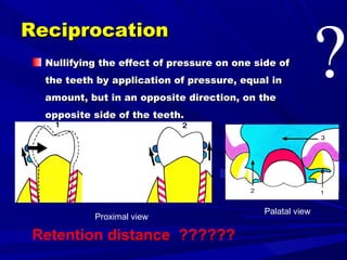 Reciprocal Tooth 3- Basic principles for designing the removable partial denture | PPT