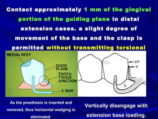 3- Basic principles for designing the removable partial denture | PPT