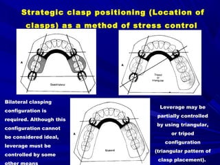 3- Basic principles for designing the removable partial denture | PPT