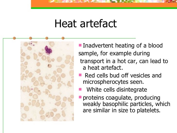 2. blood cells morphology