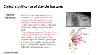 Clinical significance of clavicle fracture:
A function of the clavicle is to transmit
forces from the upper limb to the axial
skeleton. Thus, the clavicle is the most
commonly fractured bone in the body.
Fractures commonly result from a fall onto
the shoulder, or onto an outstretched
hand.
The most common point of fracture is the
junction of the medial 2/3 and lateral 1/3.
After fracture, the lateral end of the
clavicle is displaced inferiorly by the weight
of the arm, and medially, by the pectoralis
major. The medial end is pulled superiorly,
by the sternocleidomastoid muscle.
Fracture of
the clavicle:
Only on the boys’ slides
 