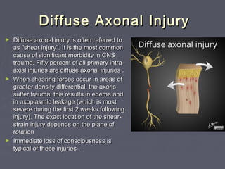2- Brain emergency | PPT