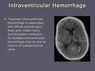Intraventricular Rupture 2- Brain emergency | PPT