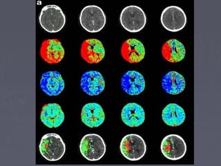 2- Brain emergency | PPT
