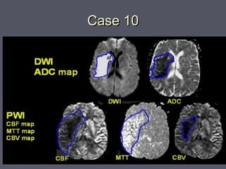 2- Brain emergency | PPT