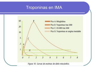 Troponinas en IMA
 