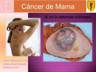 Cáncer de Mama Si no lo detectas a tiempo…. Aasith Villavicencio Paz Julissa Flores Huamán Medicina UPCH 
