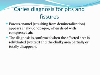Caries diagnosis for pits and
fissures
 Porous enamel (resulting from demineralization)
appears chalky, or opaque, when dried with
compressed air.
 The diagnosis is confirmed when the affected area is
rehydrated (wetted) and the chalky area partially or
totally disappears.
 