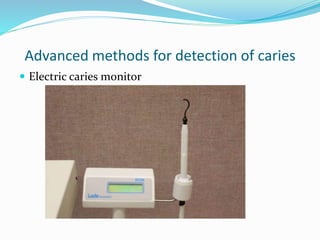 Advanced methods for detection of caries
 Electric caries monitor
 