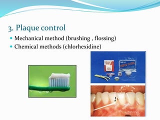 3. Plaque control
 Mechanical method (brushing , flossing)
 Chemical methods (chlorhexidine)
 