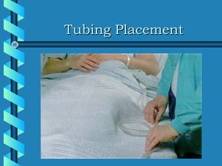 Tubing Placement
 