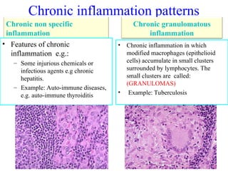 2- chronic inflammlation1-2 pathology.ppt