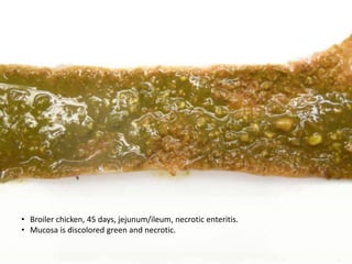 Clostridia Infection | PPTX