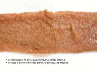Clostridia Infection | PPTX