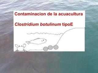 Contaminacion de la acuacultura  Clostridium botulinum  tipoE 