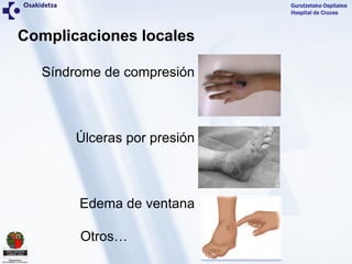 Gurutzetako Ospitalea
Hospital de Cruces
Complicaciones locales
Síndrome de compresión
Úlceras por presión
Edema de ventan...