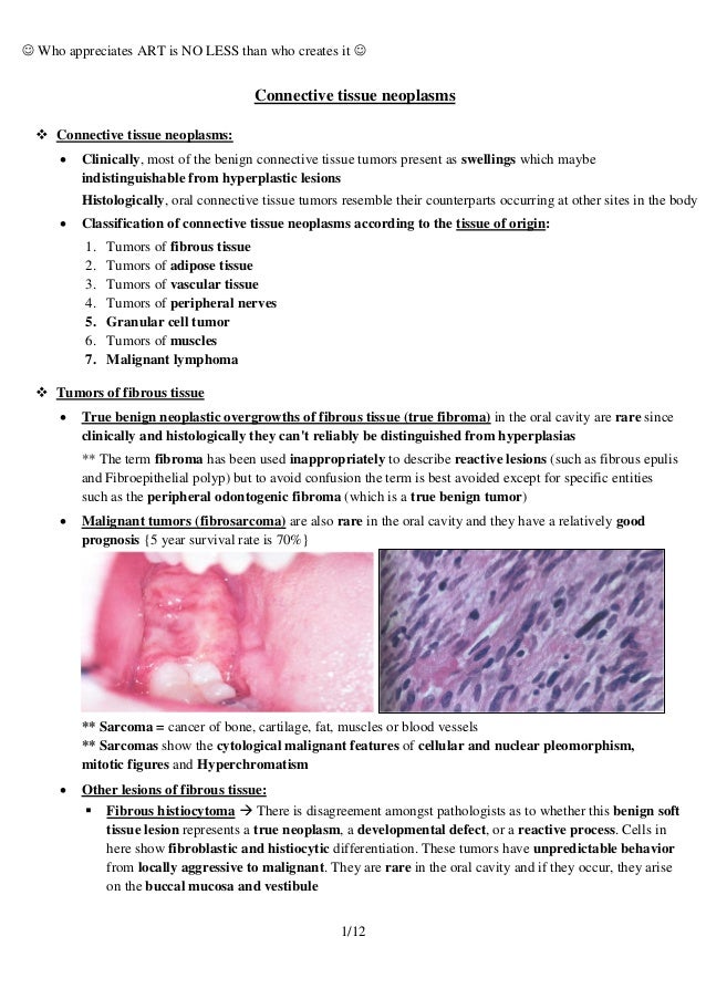 malignancy of connective tissue 2 connective tissue neoplasms malignancy of connective tissue 2 connective tissue neoplasms