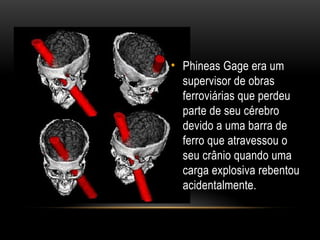 • Phineas Gage era um
supervisor de obras
ferroviárias que perdeu
parte de seu cérebro
devido a uma barra de
ferro que atravessou o
seu crânio quando uma
carga explosiva rebentou
acidentalmente.
 