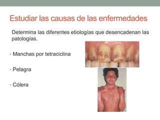 Estudiar las causas de las enfermedades
Determina las diferentes etiologías que desencadenan las
patologías.
• Manchas por tetraciclina
• Pelagra
• Cólera
 